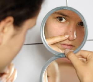 أسباب حب الشباب و طرق الوقايه منه